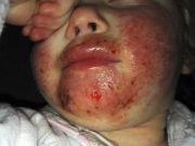8 měsíců nikdo nevěděl zjistit na jakou nemoc trpí tato 2letá holčička. Tehdy její máma zjistila šokující pravdu!
