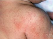 POKUD JSTE NA SOBĚ NAŠLI TĚCHTO 8 PŘÍZNAKŮ, TĚLO SE VÁM SNAŽÍ ŘÍCT NĚCO VELMI DŮLEŽITÉHO