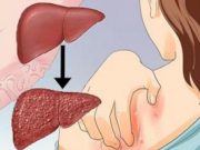 Neuvědomila si, že tyto příznaky jsou známkou nemoci. Už pro ni bylo pozdě. Určitě si přečtěte asi 13 znamení, která vám zachrání život