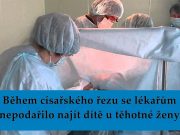 Během císařského řezu se lékařům nepodařilo najít dítě u těhotné ženy