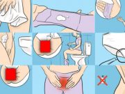 Co vám gynekolog nikdy neřekne: produkt, který ničí plísně, bakterie a nepříjemný zápach