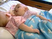 V roce 2011 podstoupila tato siamská dvojčata separační operaci. Podívejte se, jak vypadají o 10 později