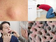 10 nejnechutnějších věcí v našem těle, které představují přímou hrozbu pro zdraví