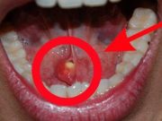 9 příznaků rakoviny lidé obvykle ignorují, dokud není pozdě