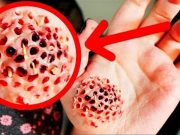 Nejpodivnější a nejvíce šokující stvoření mohou žít v našem těle!