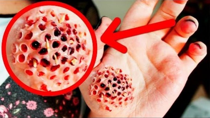 520