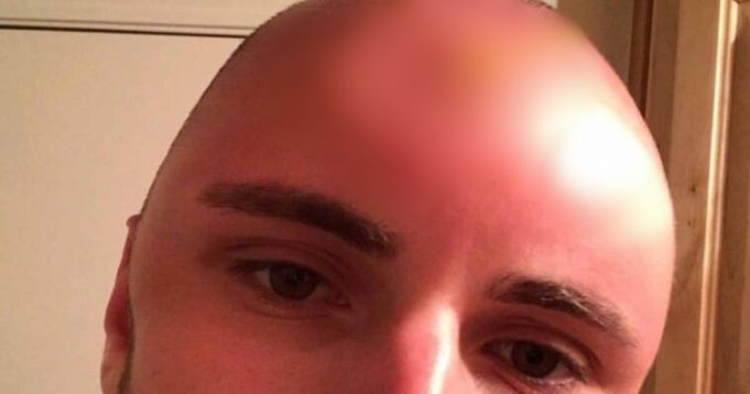 777