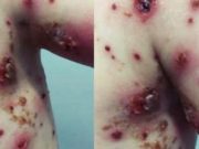 Po užití pilulky dítě křičelo bolestí na celý dům. Pak si moje matka uvědomila, co doktor udělal