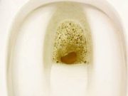 Vidíte bubliny v moči? Pozor může to mít vážné onemocnění