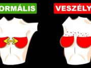 6 nebezpečných problémů s prsy, které mohou výrazně ohrozit vaše zdraví