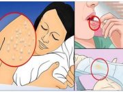 10 varovných příznaků, které naznačují infekci HIV a většina lidí si ji mýlí s jinou chorobou!