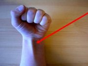 Vybočuje šlacha také na vašem zápěstí? Pak to lépe víte!