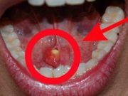 25 příznaků rakoviny lidé obvykle ignorují, dokud není příliš pozdě