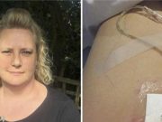 Lékaři řekli ženě, že měla vaginální herpes, ale o 20 let později se dozvěděla něco strašného