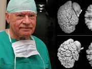 Neurochirurgové bijí na poplach. Každá žena by měla znát tato fakta!