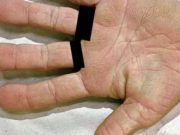 Ano, vaše ruka skutečně ukazuje, zda dostanete rakovinu – Sledujte toto!