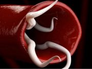 6 příznaků, které naznačují přítomnost parazitů ve střevech