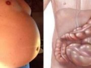NALÉHAVÉ: 1 JÍDLO JE HLAVNÍ PŘÍČINOU OBEZITY: Tvoří břišní tuk a ohrožuje zdraví
