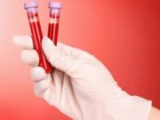 LIDÉ S TÉTO KREVNÍ SKUPINOU ŽIJÍ NEJDÉLE: JSOU ODOLNĚJŠÍ VŮČI VÁŽNÝM ONEMOCNĚNÍM, JAKO JE RAKOVINA, CUKROVKA A DUŠEVNÍ ONEMOCNĚNÍ