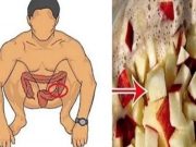 Vyčistěte si tím své tlusté střevo a můžete zhubnout až několik kilogramů za 20 dní!