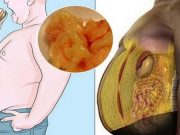VYPIJTE TENTO NÁPOJ PŘED Spánkem, ROZTAVTE KILOGRAMY VE SPÁNKU: Zbavte se nevzhledného tuku na břiše