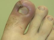 Nehty na nohou jsou obrazem zdraví: Pokud na nich zpozorujete tuto barvu, okamžitě vyhledejte lékaře – může to být příznak velmi nebezpečného onemocnění