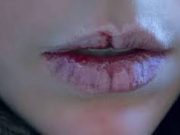 Jsou vaše rty popraskané, suché, bledé? Zde je 8 příznaků, které jsou všechny jeho příznaky!