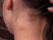 26letá žena zjistila, prostřednictvím videa na TikToku, ve kterém si vyzkoušela kosmetický trend, zdrcující zprávu. Toto by nečekala ani v nejhorším snu!
