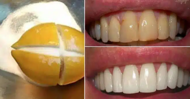 854788