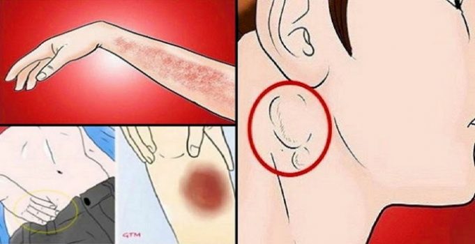 15-Cancer-Warning-Signs-People-Ignore-Until-ItE28099s-Too-Late