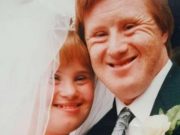 Smutný osud páru s Downovým syndromem: Jeden z nich byl hospitalizován a začala tragédie! Srdceryvný příběh vám změní pohled na život!